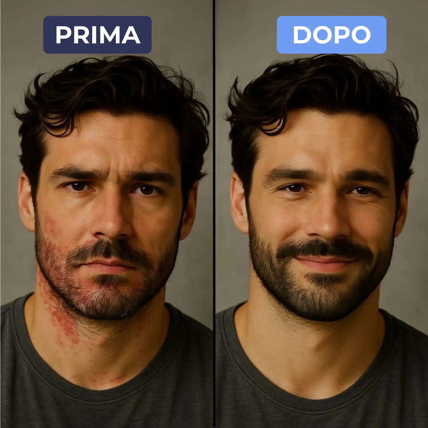 Cutamax™ ⎜ Crema lenitiva barba & cuoio capelluto