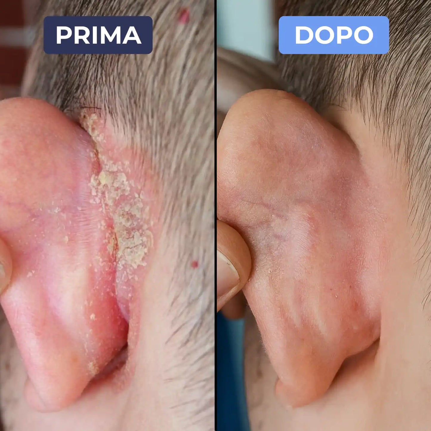 Cutamax™ ⎜ Crema lenitiva barba & cuoio capelluto