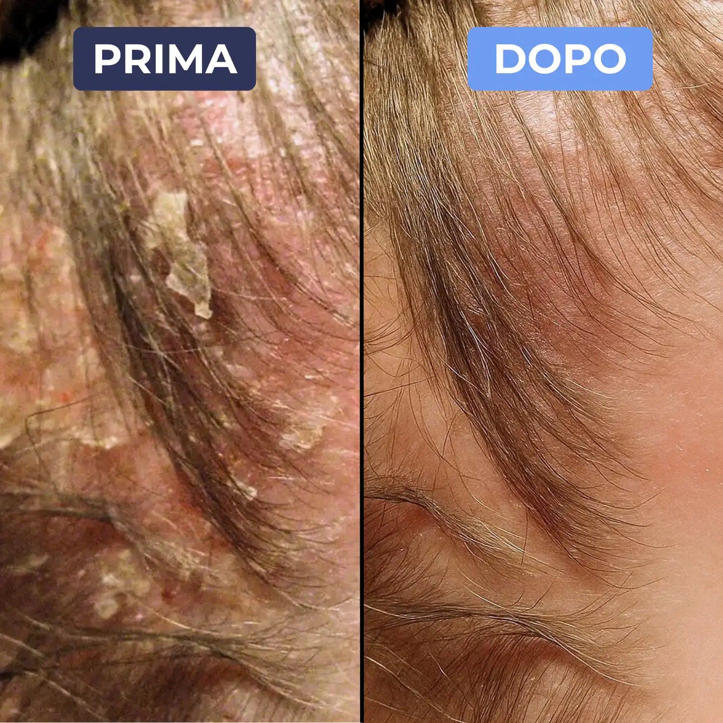 Cutamax™ ⎜ Crema lenitiva barba & cuoio capelluto